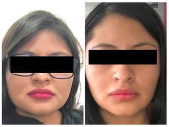 Cirugía facial - 640282