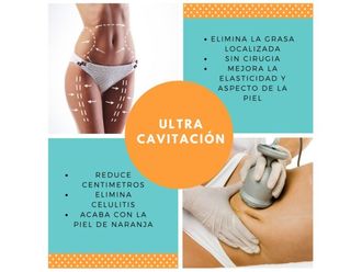 Cavitación - 640286