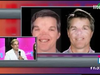 Cirugia Reconstructiva con el Dr. Marco Antonio Priego Tapia