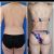 ¡El Mommy makeover Cambió mi vida! Dr. Jhon Gómez