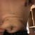Abdominoplastia, Liposuccion, gynecomastia, lipo transferencia - Daddy makeover