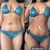 Mastopexia sin Implantes y Lipo360 con transferencia a glúteos