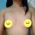 Aumento de busto implantes 420 cc