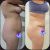 Cambio de abdomen y glúteos