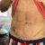 Marcaje abdominal en hombre. Excelentes resultados!!!!