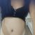 Abdominoplastia y sigo con panza