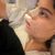 Mi experiencia con mi rinoplastia con la Dra Carmen Contreras