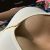 Aumento de busto Maxxiplastia