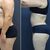 Mi abdominoplastia me encantó