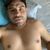 Implante de pectorales 