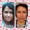 Si he visto muchos cambios en mi rostro gracias  a los tratamientos.