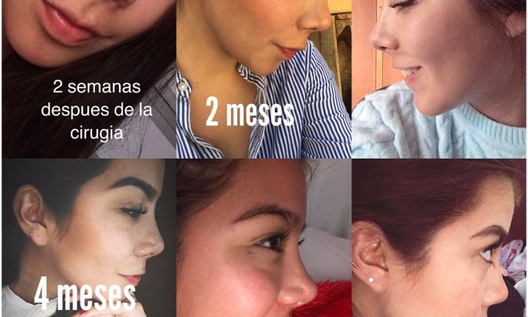 64793
