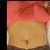 La abdominoplastia me cambio