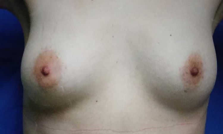 121801