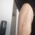 Braquioplastia mal hecha