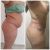 Feliz con mi lipo 👏🤗🧡