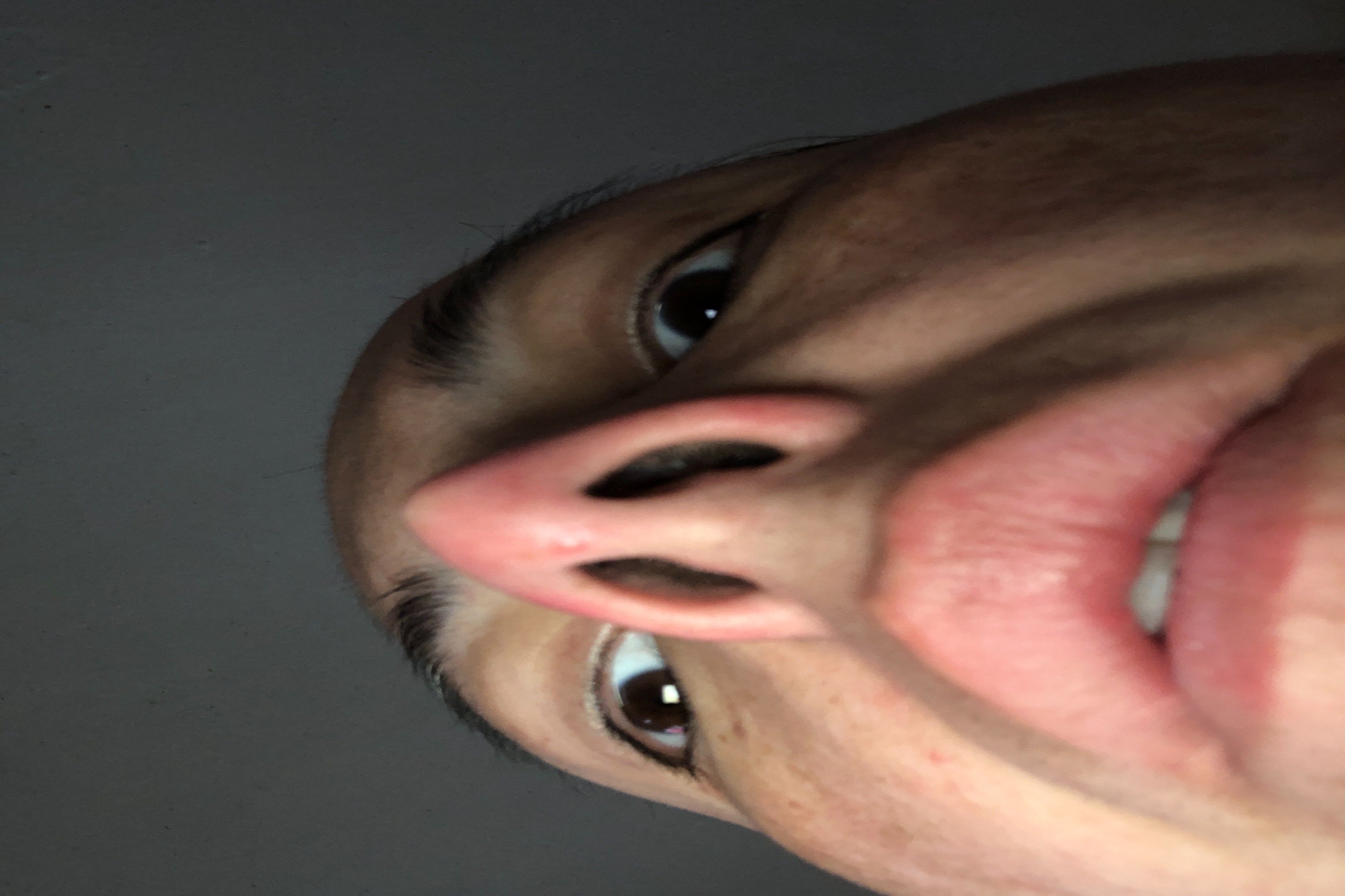 25876