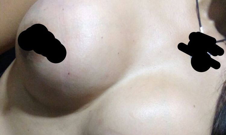 12262