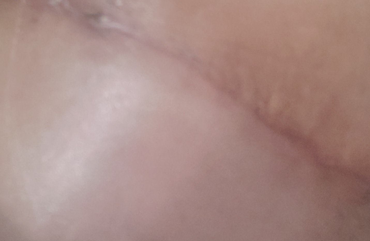 7893