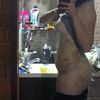 Mis resultados sobre mi aumento de busto, y lipotransferencia 