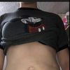 Mis resultados sobre mi aumento de busto, y lipotransferencia 