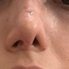 Fosas nasales asimétricas, una más grande y larga que la otra