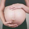 ¿En la operación de la cesárea se puede realizar la abdominoplastia?