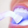 Cada cuándo se hacen el blanqueamiento dental?