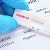 ¿Prueba de COVID-19 (Coronavirus) antes de la cirugía?