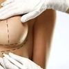 ¿Qué posición tienen tus implantes?