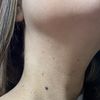 Textura y poros cuello