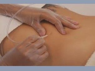 Adiós celulitis, bye estrías...Flacidez cero...