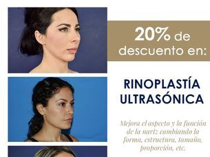 Rinoplastia ultrasónica 20%