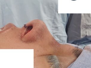 15% DESCUENTO en cirugías  por BUEN FIN