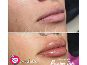 💋 ¡Consigue unos labios hidratados, definidos y con el volumen natural!