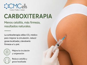 Carboxiterapia corporal