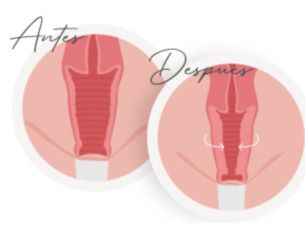 Reconstrucción Vaginal Post-Parto desde $70,000 en Hospital Certificado