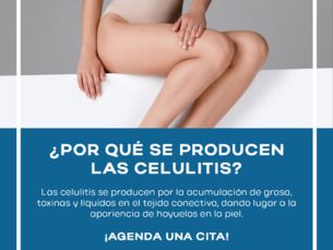 DILE ADIOS A LA CELULITIS