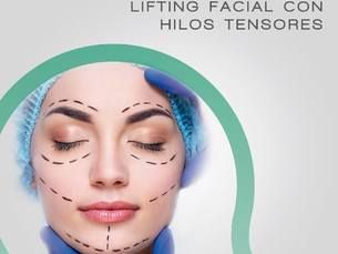Hilos tensores para lifting facial