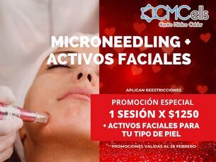 MICRONEEDLING Y ACTIVOS FACIALES - 1 Sesión por $1,250