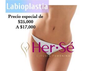 ✨Promoción especial Labioplastia ahora por $17.000