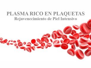 Plasma Rico en Plaquetas. Nueva tecnología