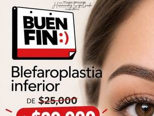 ¡Buen Fin! Blefaroplastia inferior de $25,000 a $20,000.