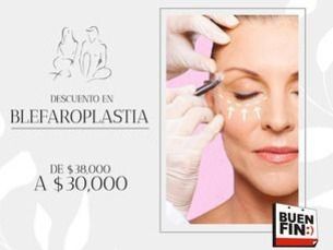 Blefaroplastia a precio especial