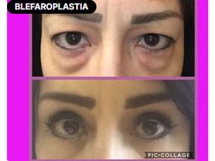 ✨¡Devuélvele la frescura, juventud y descanso a tu mirada! ✨
