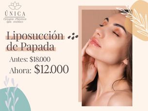 ¡Promo Especial!