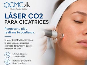 Laser Co2 para mejorar la apariencia de la piel