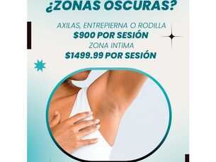 ¿ZONAS OBSCURAS?