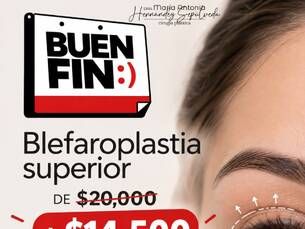 ¡Buen Fin! Blefaroplastia Superior de $20,000 a $14,500.