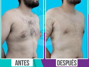 Devuelve tu figura y luce genial este 2027!